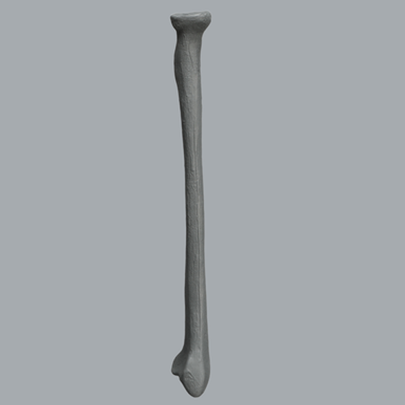Radius, Radiopaque, Left
