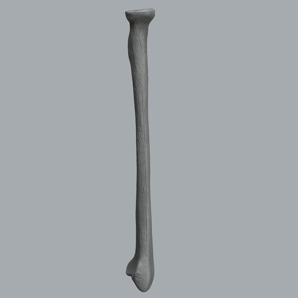 Radius, Radiopaque, Left