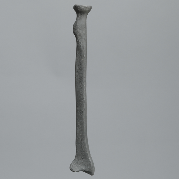 Radius, Radiopaque, Left