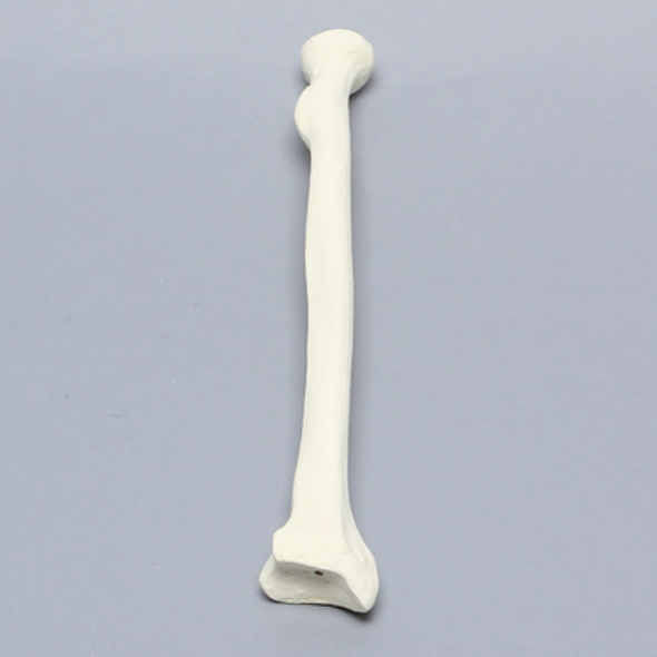 Radius, 5.5mm Canal, Foam Cortical Shell, Right