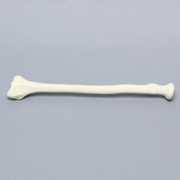 Radius, 5.5mm Canal, Foam Cortical Shell, Right