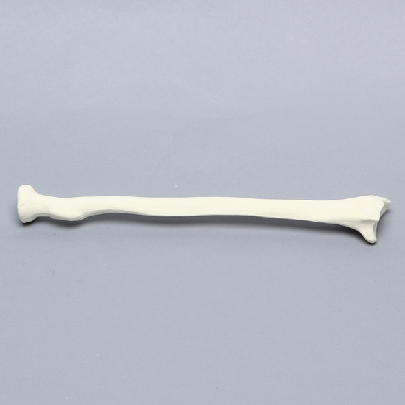 Radius, 5.5mm Canal, Foam Cortical Shell, Right