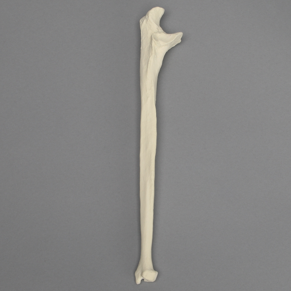 Ulna, 5mm Canal, Foam Cortical Shell, Right