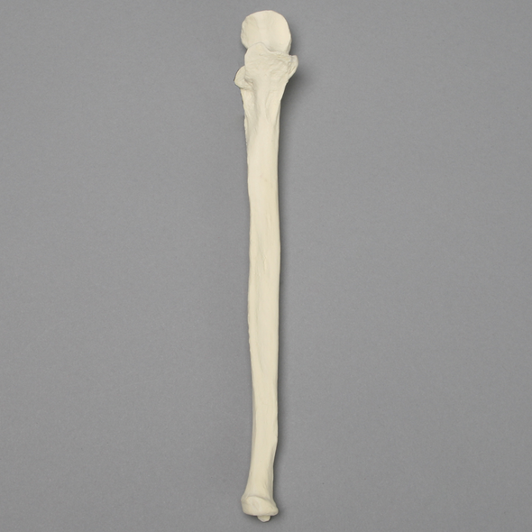 Ulna, 5mm Canal, Foam Cortical Shell, Right