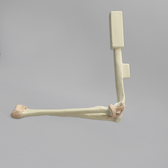 Arthroscopy Elbow Insert with Capsule and Cartilage