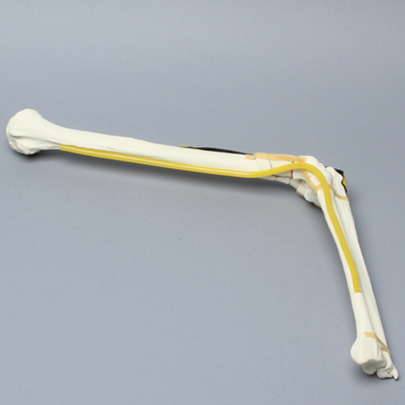 Elbow with Six-Part Fracture, Nerve, and Tendon, Foam Cortical