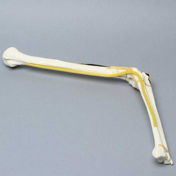 Elbow with Six-Part Fracture, Nerve, and Tendon, Foam Cortical