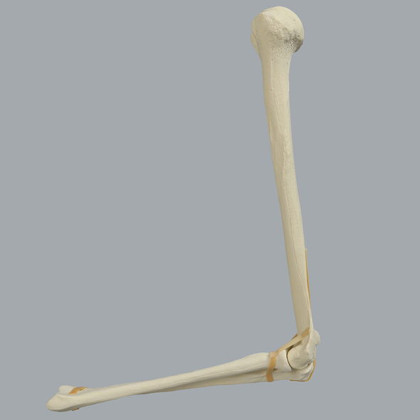 Elbow with Foam Cortical Humerus & Ulna, Solid Foam Radius