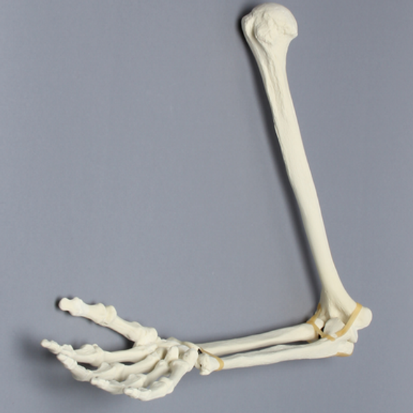 Arm, Foam Cortical Shell, Right