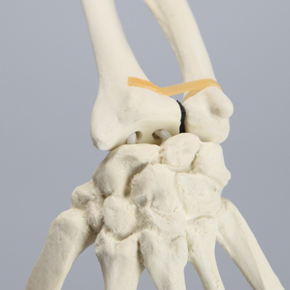 Hand and Wrist without Canal, Solid Foam