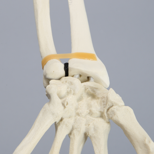 Hand and Wrist without Canal, Solid Foam