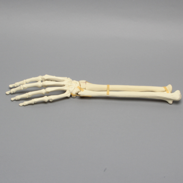 Hand and Wrist with Four-Part Fracture, Foam Cortical