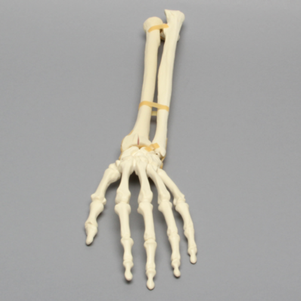 Hand and Wrist with Four-Part Fracture, Foam Cortical