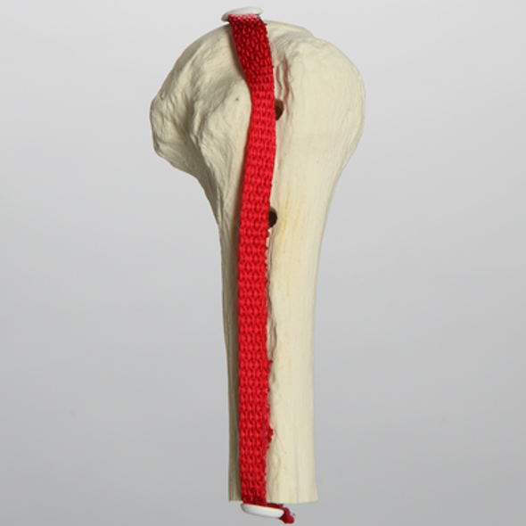 Biceps Tendon Model, Solid Foam