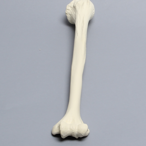 Humerus Unplugged, 9.5mm Canal, Solid Foam