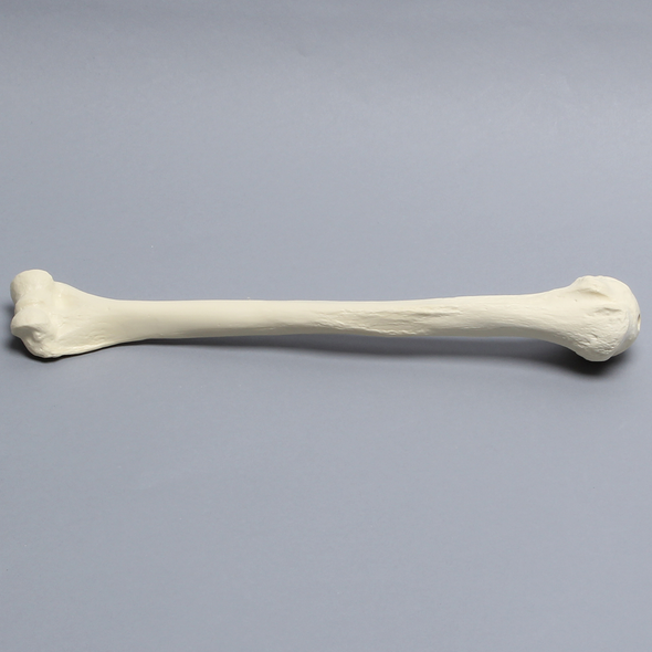Humerus Unplugged, 9.5mm Canal, Solid Foam
