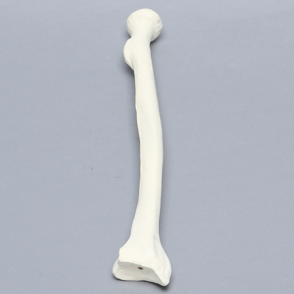 Radius, 6.4mm Canal, Solid Foam, Right