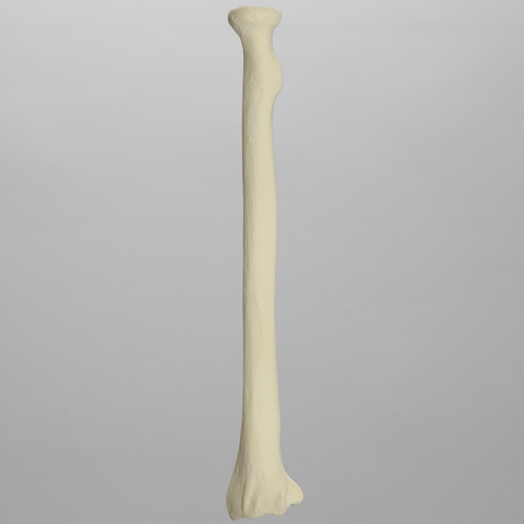Radius, 6.4mm Canal, Solid Foam, Left