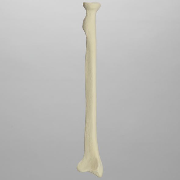 Radius, 6.4mm Canal, Solid Foam, Left