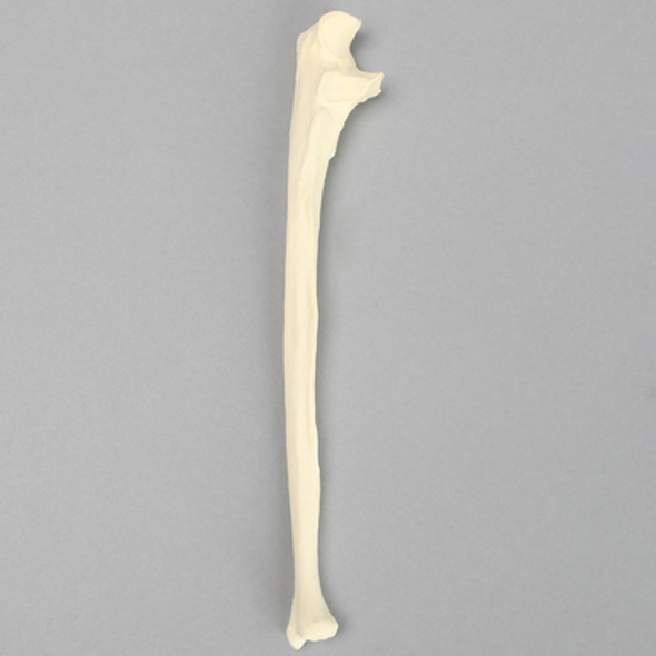 Ulna with Arthritis, Solid Foam, Female