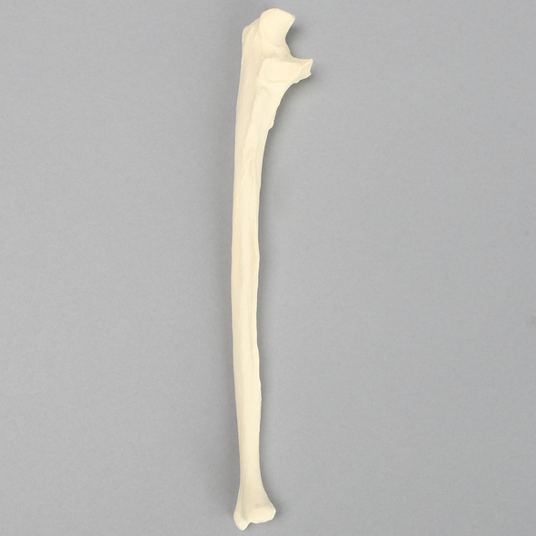 Ulna with Arthritis, Solid Foam, Female