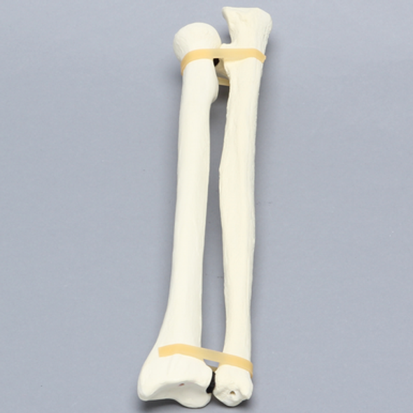 Ulna and Radius, 5.5mm Canal, Solid Foam