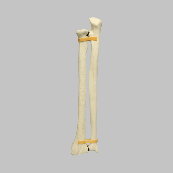 Ulna and Radius, 5.5mm Canal, Solid Foam