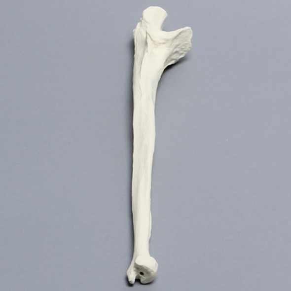Ulna, 5mm Canal, Solid Foam, Right