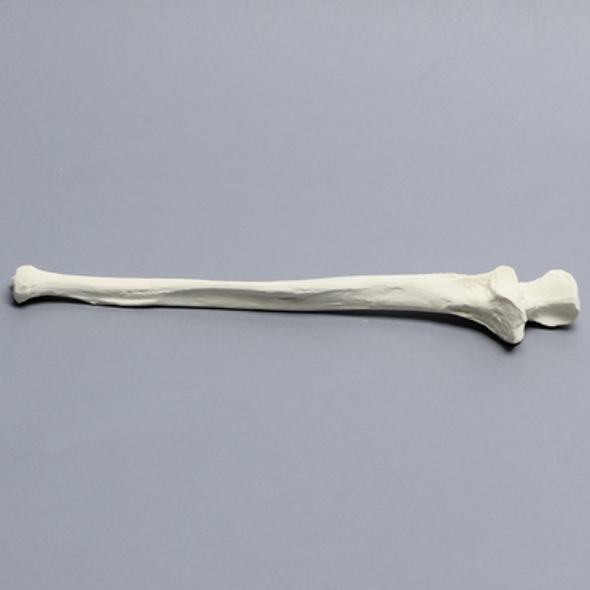 Ulna, 5mm Canal, Solid Foam, Right