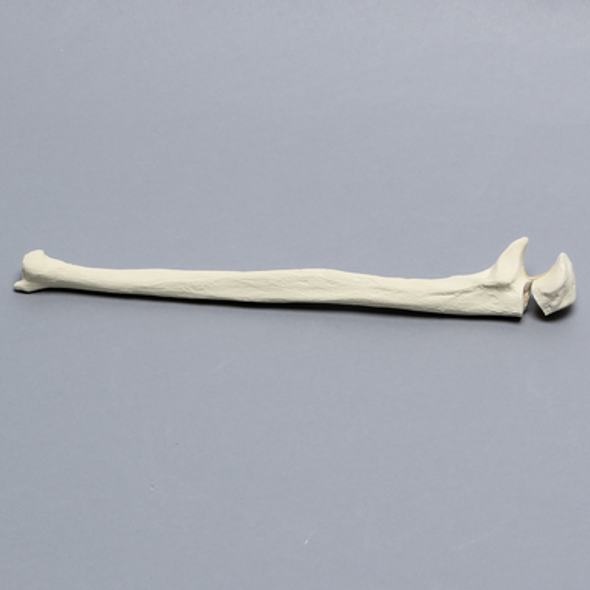 Ulna with Olecranon Fracture, Solid Foam