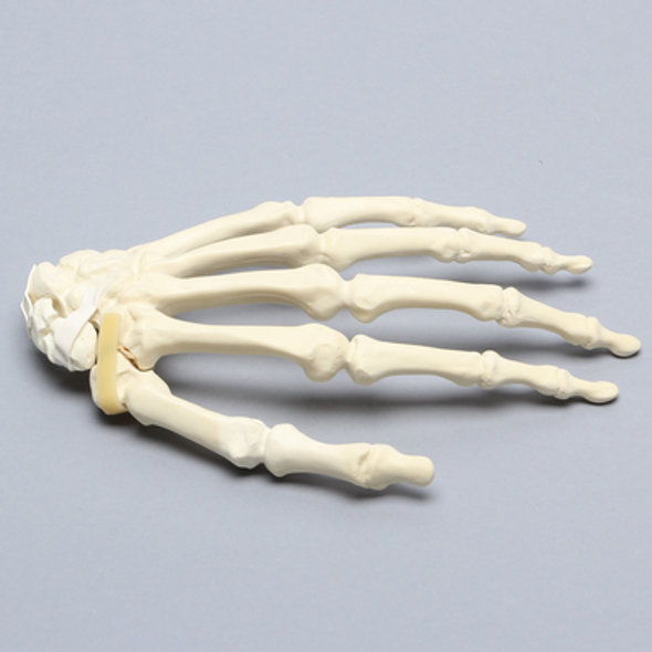 Hand with Scaphoid Fracture and Articulated Metacarpal, Solid Foam