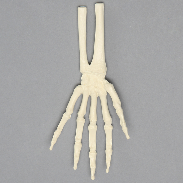 Hand and Wrist, Pediatric, Solid Foam