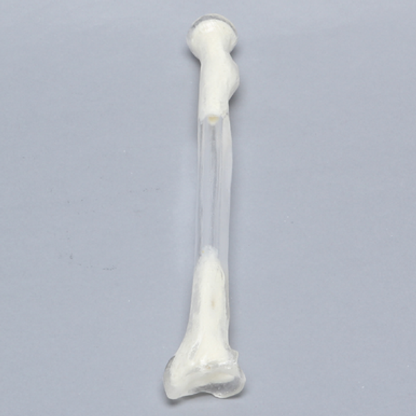 Radius, 5.5mm Canal, Transparent Cortical