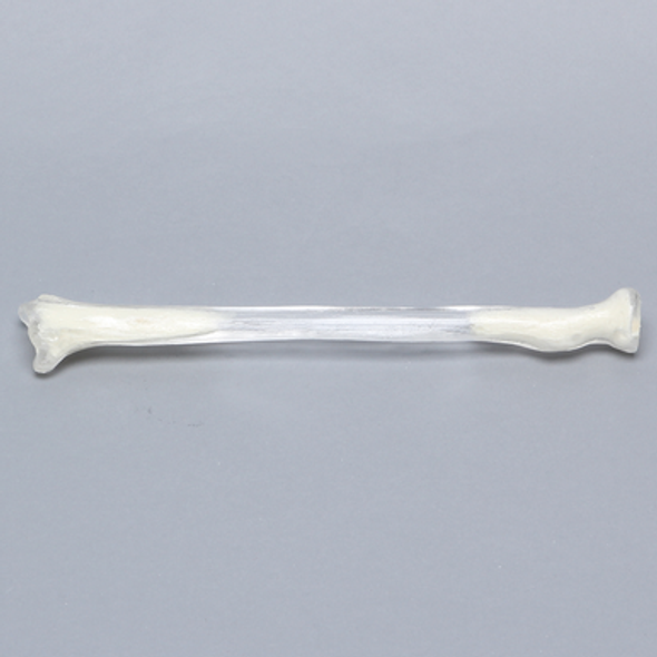 Radius, 5.5mm Canal, Transparent Cortical