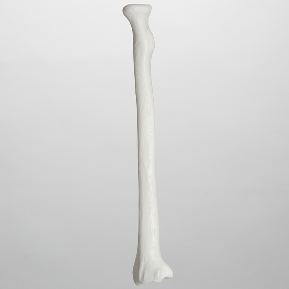 Radius, 5.5 mm Canal, Plastic Cortical Shell