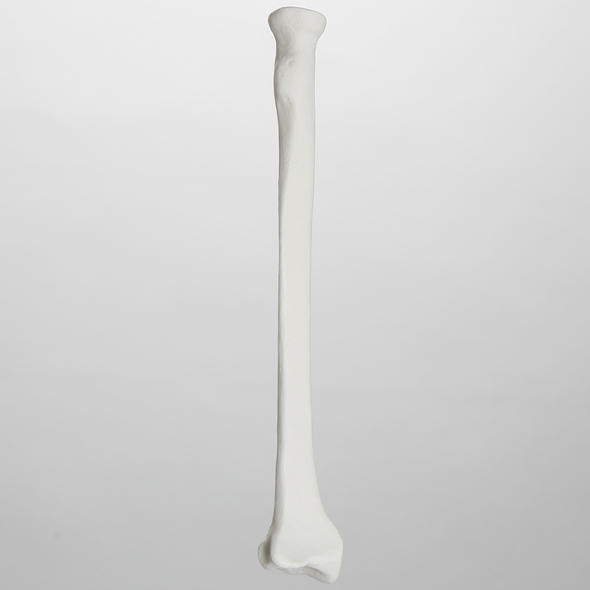Radius, 5.5 mm Canal, Plastic Cortical Shell