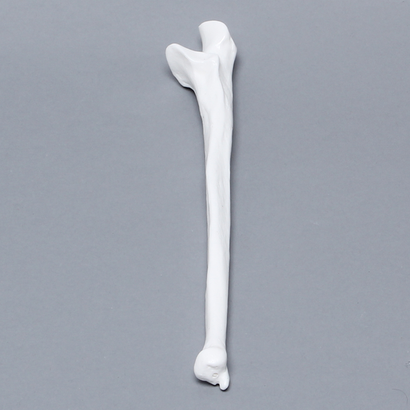 Ulna, 5mm Canal, Plastic Cortical
