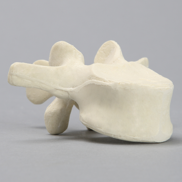 Vertebra, L3, Solid Foam