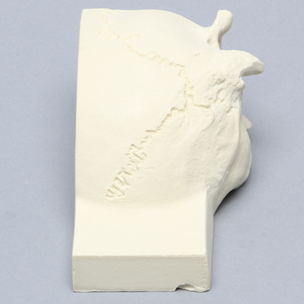 Skull, Posterolateral Quarter Section