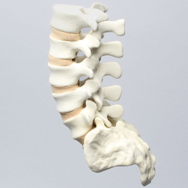 Spine, Lumbar with Tan Discs and Single Ligament, Solid Foam