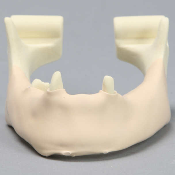 Mandible with Mucosa, Partially Edentulous