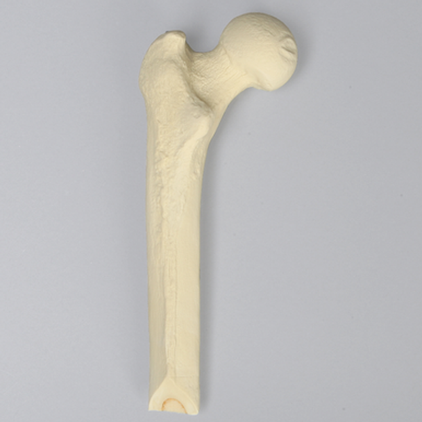 Femur with Plugged Distal Canal, Proximal