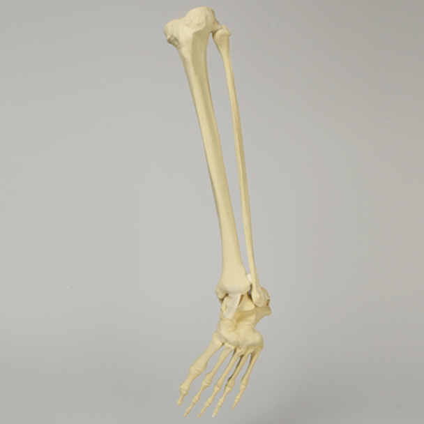Foot and Ankle with Clubfoot and Equinus Deformities