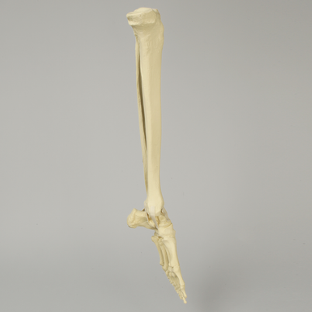 Foot and Ankle with Clubfoot and Equinus Deformities