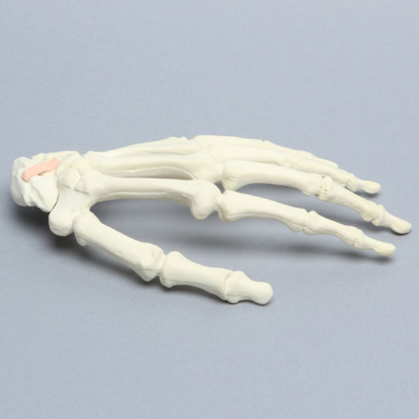 Hand with Moveable Scaphoid, Solid Foam