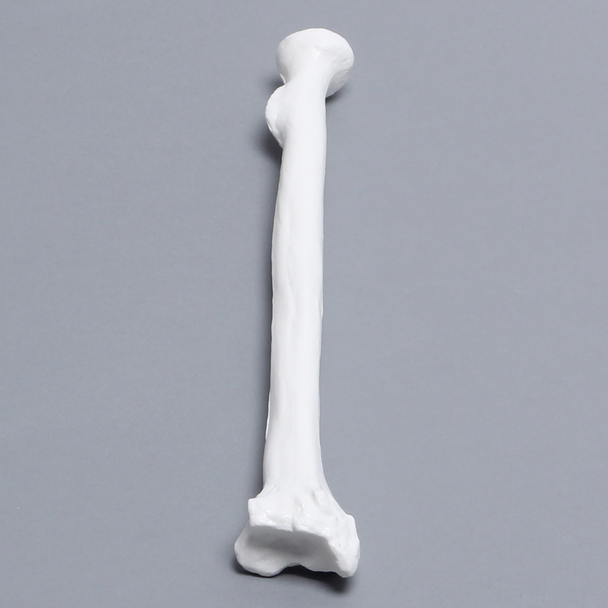 Radius, Solid White Plastic, Right