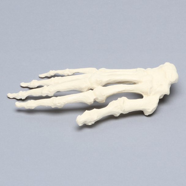 Female Hand, Arthritic, Solid Foam