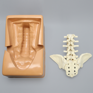 Lumbar Holder with Iliac Wing Cutouts