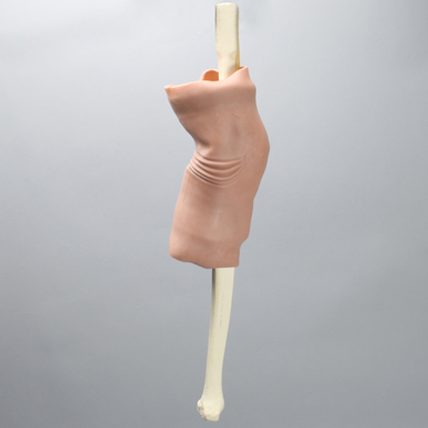 Knee without Clamps, Arthroscopy