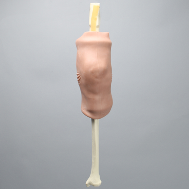 Knee without Clamps, Arthroscopy